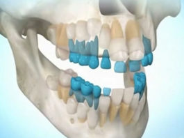 Попрощайтесь с зубными имплантатами, Вы можете вырастить собственные зубы за 9 недель!