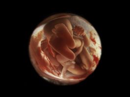25 ошеломляющих снимков, показывающих что происходит внутри мамы во время беременности