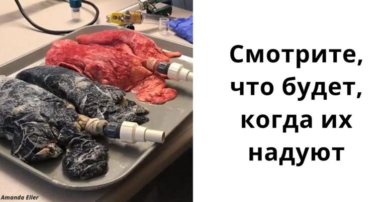 Вот чем отличаются легкие курильщика и здорового человека!
