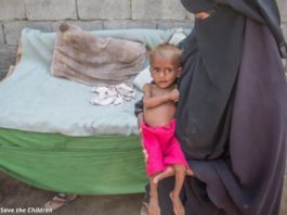 Голод в Йемене унёс жизни 85 000 детей. Почему весь мир молчит?!