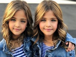 В 7 лет их назвали самыми красивыми близнецами. Вот как они выглядят сейчас