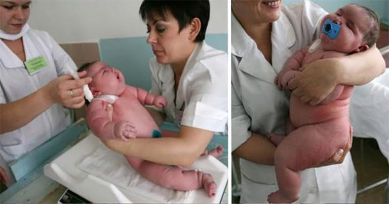 Женщина родила 18-ти килограммового малыша! Как думаете, сколько весит его мама?