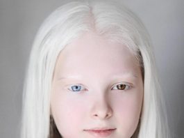«Чеченка с необычной внешностью стала звездой интернета»: как живет и чем сегодня занимается 12-летняя амина