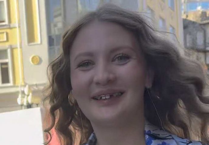 “Мне сделала операцию по наращиванию кости”. Невестка Королевой показала первое фото после операции