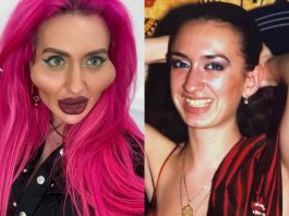 Ее визитная карточка — это скулы. Известная киевлянка отметила свое 34-летие и показала, как выглядела до пластики