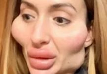 Пользователи Сети схватились за сердце, увидев украинку с большими скулами в прозрачном 6елье