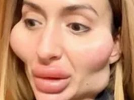 Пользователи Сети схватились за сердце, увидев украинку с большими скулами в прозрачном 6елье