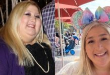 Женщину с обвисшей кожей критиковали в интернете. Она не растерялась и дала язвительный ответ ненавистникам