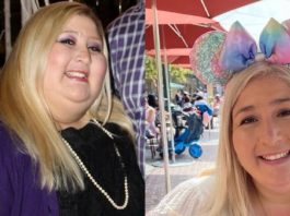 Женщину с обвисшей кожей критиковали в интернете. Она не растерялась и дала язвительный ответ ненавистникам