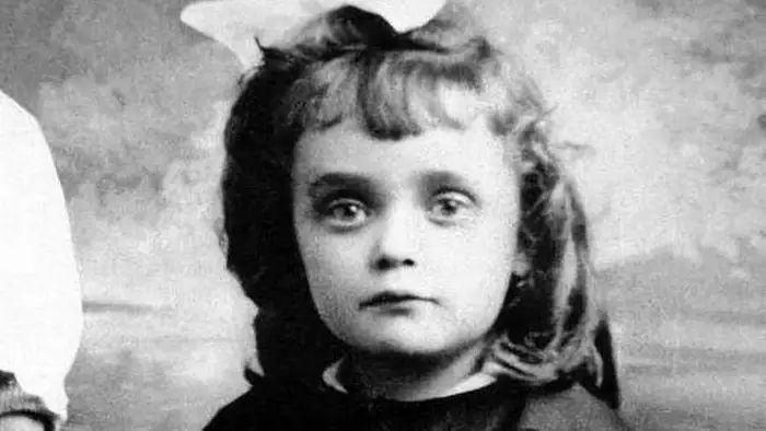 Родилась на улице и едва не ослепла, но спустя годы покорила мир
